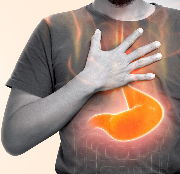 Acidity treatment — MindFlora probiotic solution